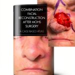 CRC Press Cosmetic & Reconstructive Surgery eBook 2023 Edition-0