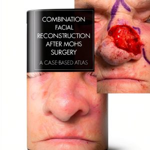 CRC Press Cosmetic & Reconstructive Surgery eBook 2023 Edition-0